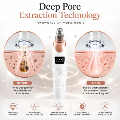 Electric Blackhead Remover – Facial Pore Vacuum with Multiple Suction Levels